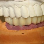 Smile Gallery image