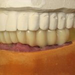 Smile Gallery image