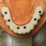 Smile Gallery image
