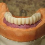 Smile Gallery image