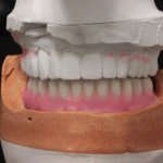 Smile Gallery image