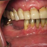 Smile Gallery image