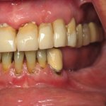Smile Gallery image