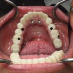 Smile Gallery image
