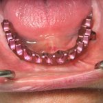 Smile Gallery image