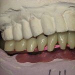 Smile Gallery image