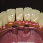 Smile Gallery image