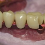Smile Gallery image