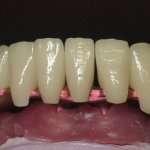 Smile Gallery image