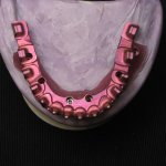 Smile Gallery image