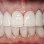 smiling North Shore Dental patient