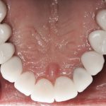 Smile Gallery image