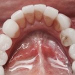 Smile Gallery image