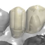 Smile Gallery image