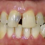 Smile Gallery image
