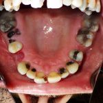 Smile Gallery image