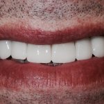 smiling North Shore Dental patient