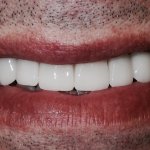 smiling North Shore Dental patient
