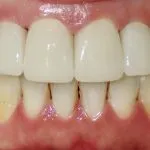 Smile Gallery image