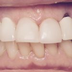 Smile Gallery image