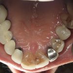 Smile Gallery image