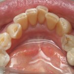 Smile Gallery image