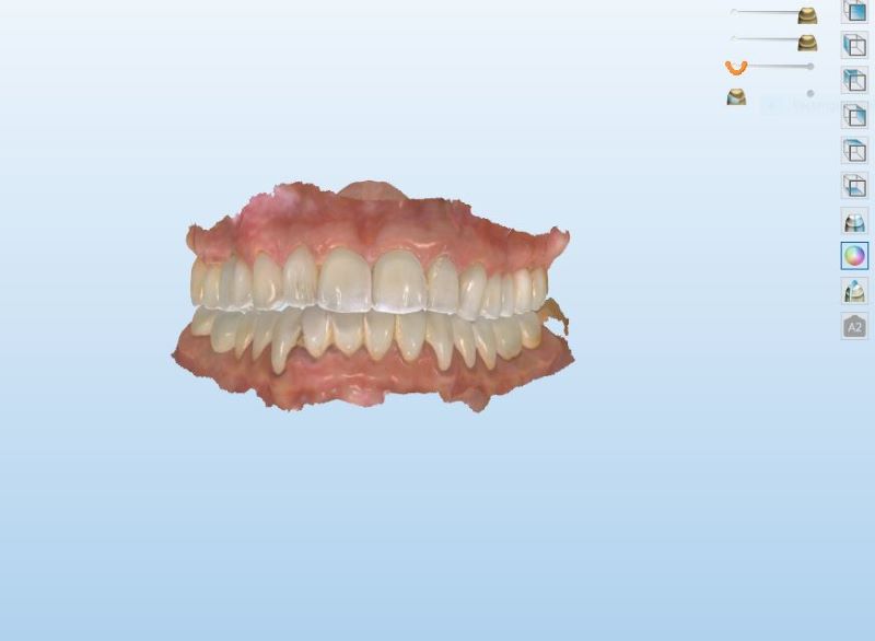 Simulated Treatment Plan