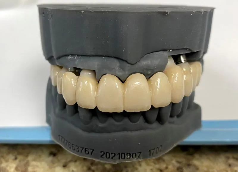 multiple dental implants