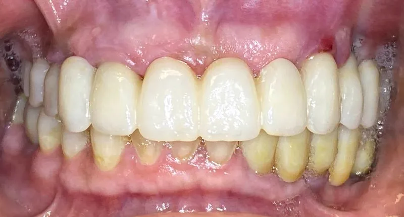 new smile, North Shore Dental