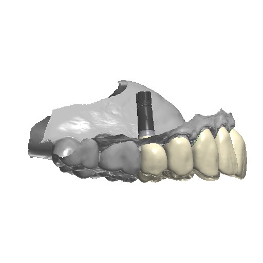 Case 41, Treatment Plan