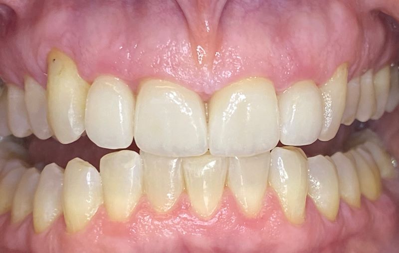 new smile, North Shore Dental