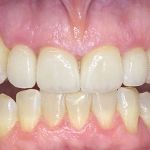 new smile, North Shore Dental