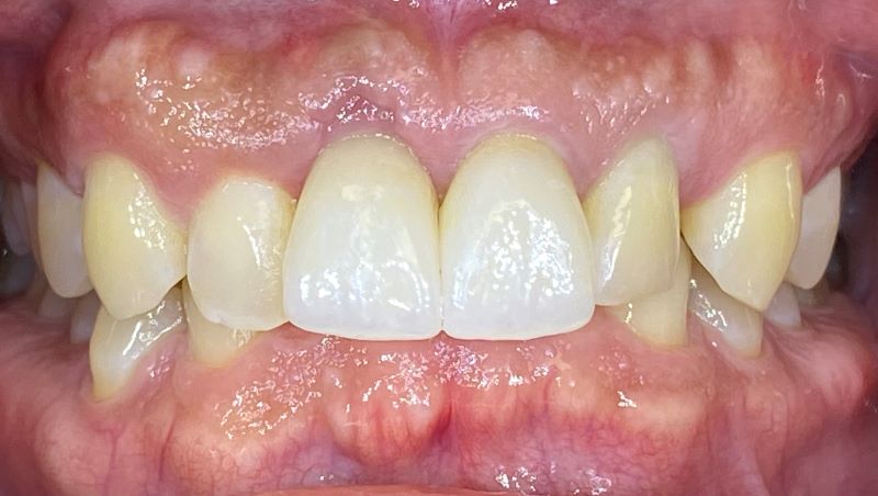 new smile, North Shore Dental