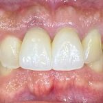 new smile, North Shore Dental