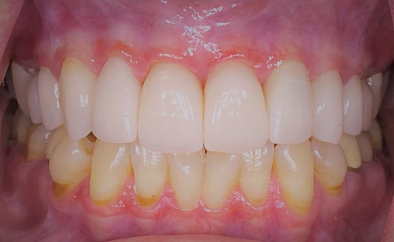 new smile, North Shore Dental
