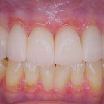 new smile, North Shore Dental