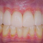 new smile, North Shore Dental