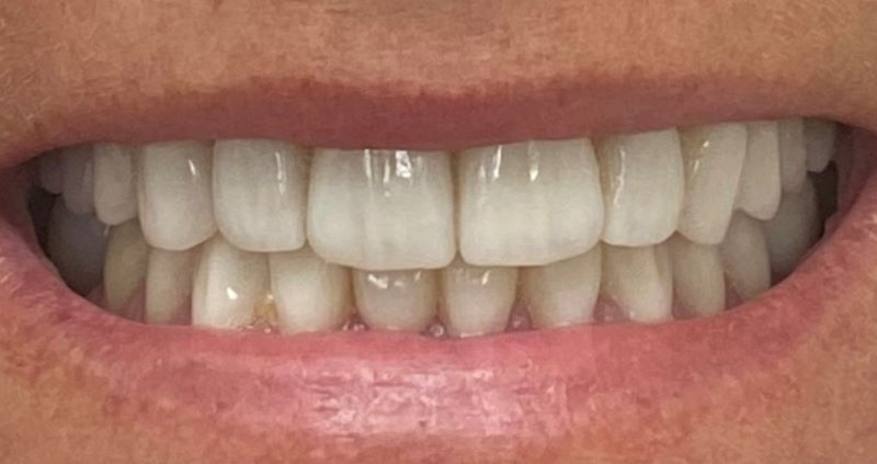 new smile, North Shore Dental