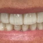 new smile, North Shore Dental