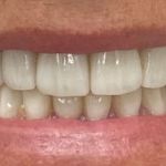 new smile, North Shore Dental