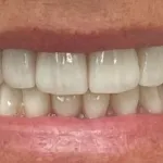 new smile, North Shore Dental