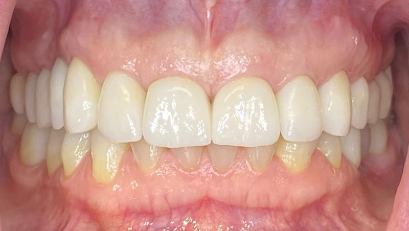 new smile, North Shore Dental