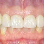 new smile, North Shore Dental